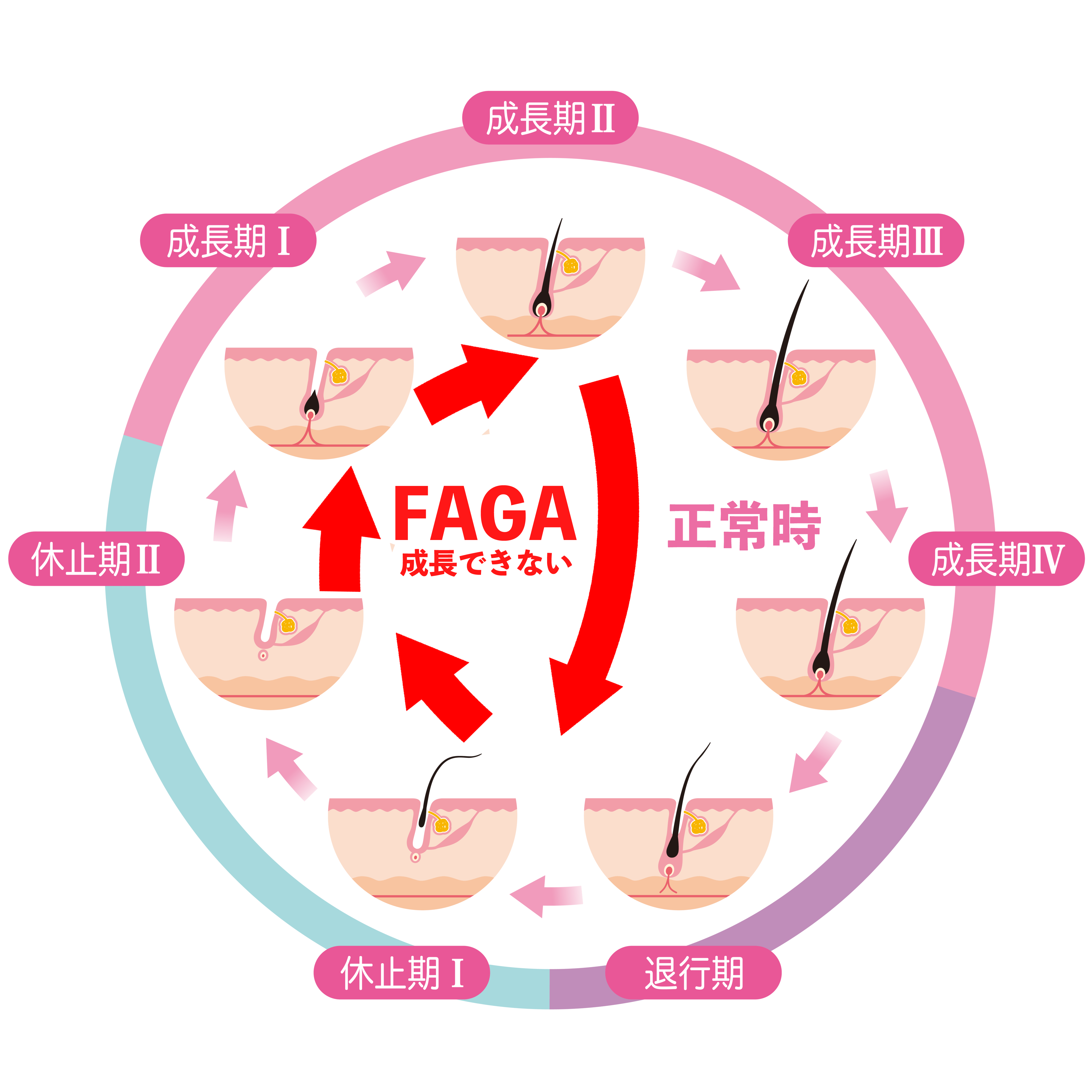 FAGA毛髪サイクル